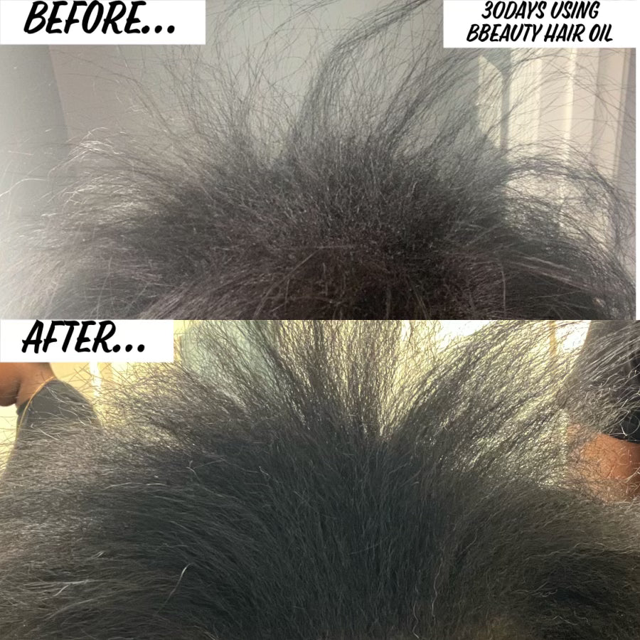 Bbeauty Strengthen and Shine Hair and Body Oil- Free Shipping on U.S. Orders